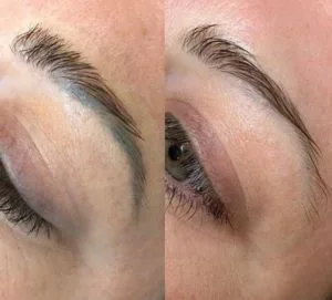 Avant / Après — retrait d'un maquillage permanent des sourcils